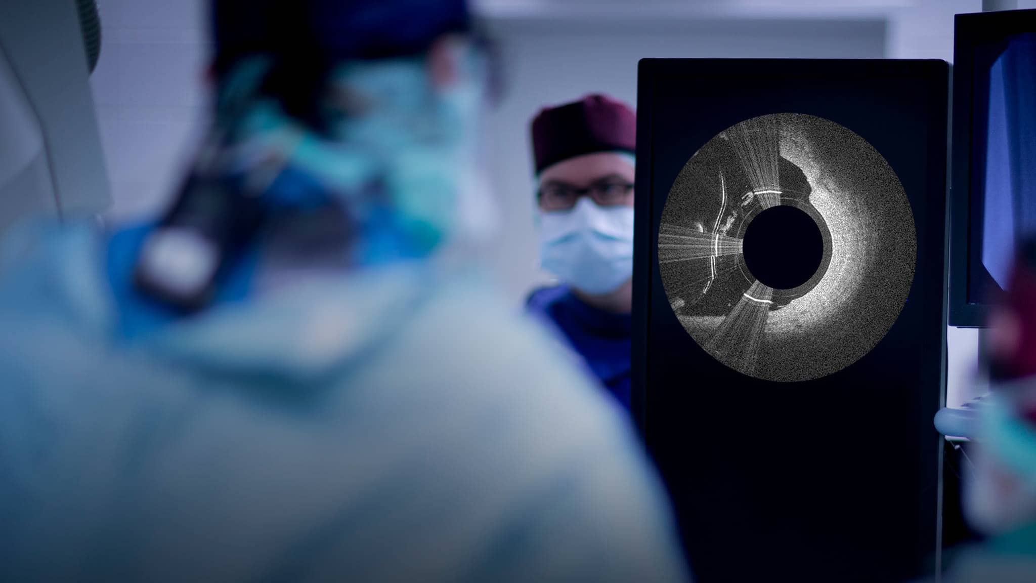 Avinger Inc. (AVGR) Soars 6.95 on February 25 Biotech Today