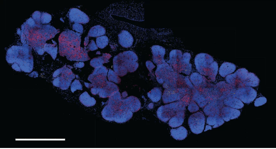 Thymus atlas could spark new treatments for cancer, autoimmune disease