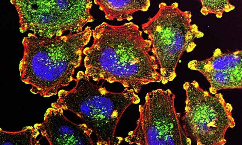 Immuno-oncology combination for melanoma using Nektar drug boosts cell therapy in mice