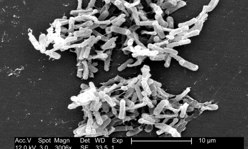 Finch Therapeutics’ microbiome med quells stubborn C. difficile