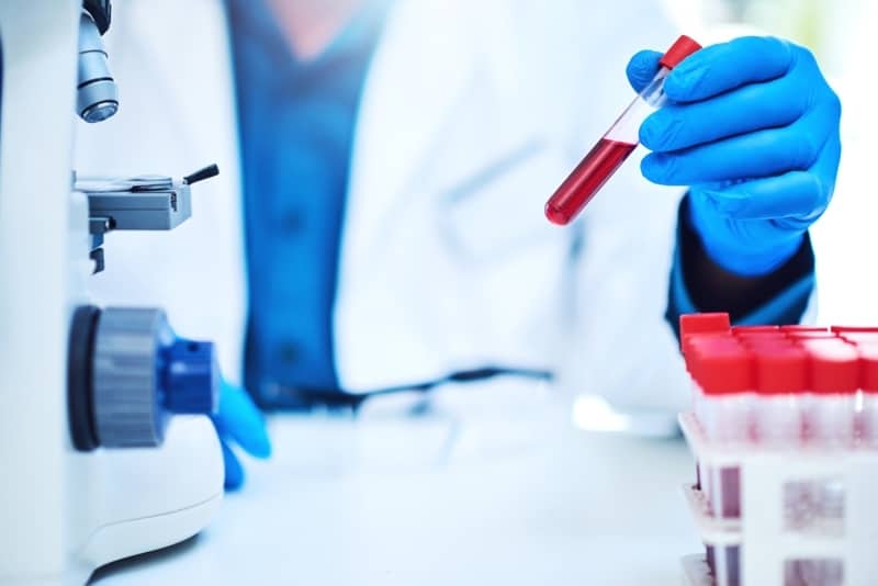 Foundation Medicine acquires liquid biopsy developer Lexent Bio