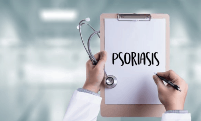 Bimekizumab Superior to Cosentyx® in Achieving Complete Psoriasis Skin Clearance