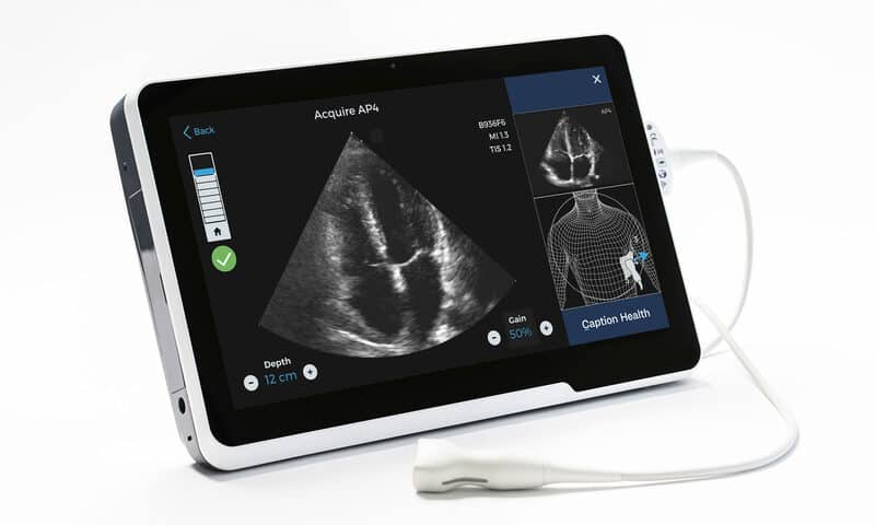 AI-guided ultrasound developer Caption Health raises $53M for further rollout