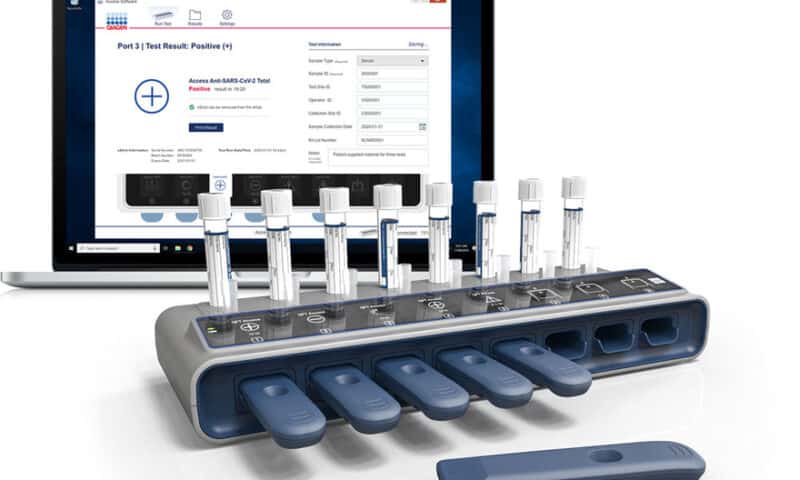 Qiagen to launch digital, portable test for COVID-19 antibodies, preordering 900K for U.S.