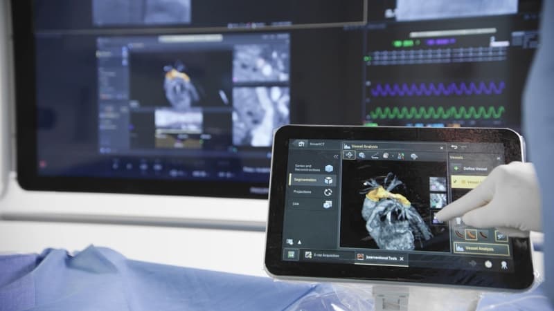 Philips relaunches its Azurion image-guided therapy platform, with automated 3D scanning