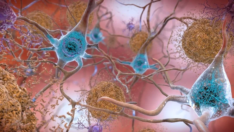 A safer Alzheimer’s drug than Biogen’s aducanumab? Denali-WashU drug shows better profile in mice