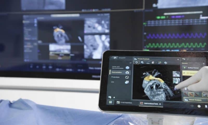 Philips’ SmartCT 3D imaging software scores FDA clearance