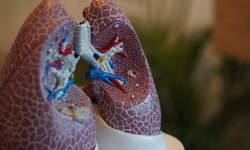 New data set up Veracyte’s nasal swab lung cancer test for launch later this year