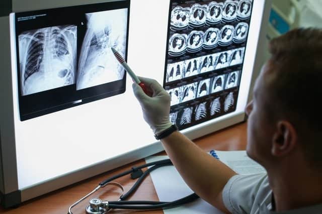 Viz.ai upgrades triage platform with Avicenna.AI’s pulmonary embolism, aortic dissection detection