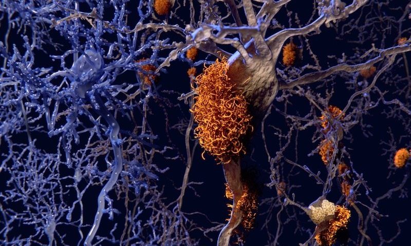 Attacking Alzheimer’s by protecting synapses from amyloid beta