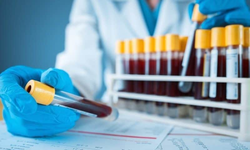 NIH blood test spots cancerous tumors in people with NF1, most common cancer predisposition syndrome: study