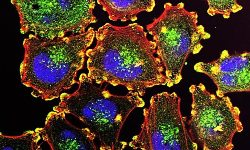Newly discovered immune cells block melanoma metastasis in mice and could inspire new treatments