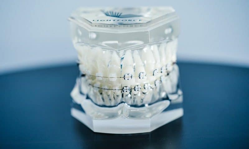 3D-printed braces maker LightForce Orthodontics sinks teeth into $50M funding round