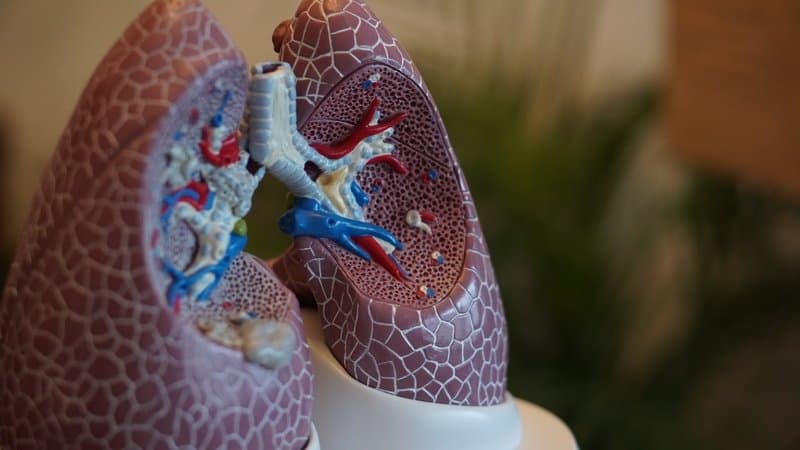 Eloxx ends long wait for phase 2 cystic fibrosis data. Market shrugs