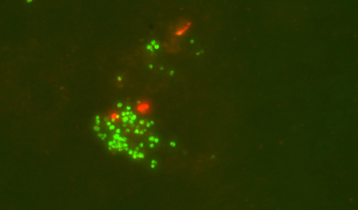 Oil Degrading Microbe Grown in Lab for the First Time