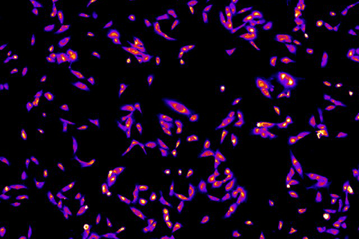 Repurposing an arrhythmia drug to fend off breast cancer metastasis: animal study