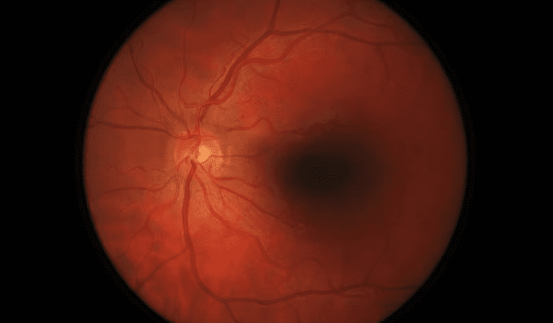 Baxter taps Digital Diagnostics’ diabetic retinopathy AI for its Welch Allyn eye scanners￼