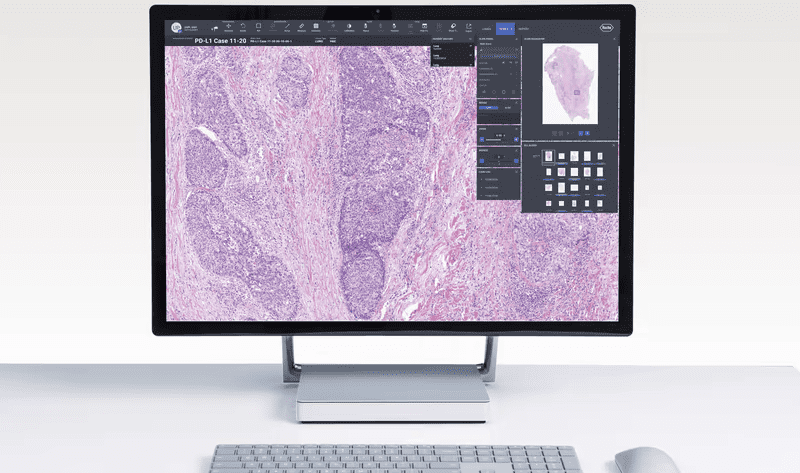 Roche, Bristol Myers partner to develop digital pathology AI to analyze clinical trial assays