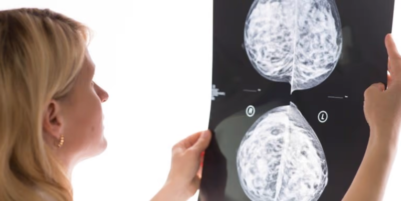 Mammogram-reading AI developer Therapixel snags €15M to expand US presence