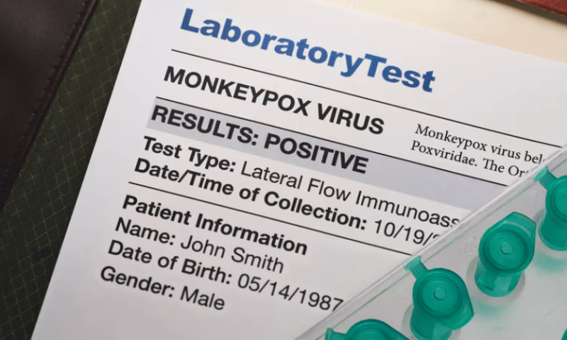 Moderna tunes vaccine platform to next potential viral threat: monkeypox