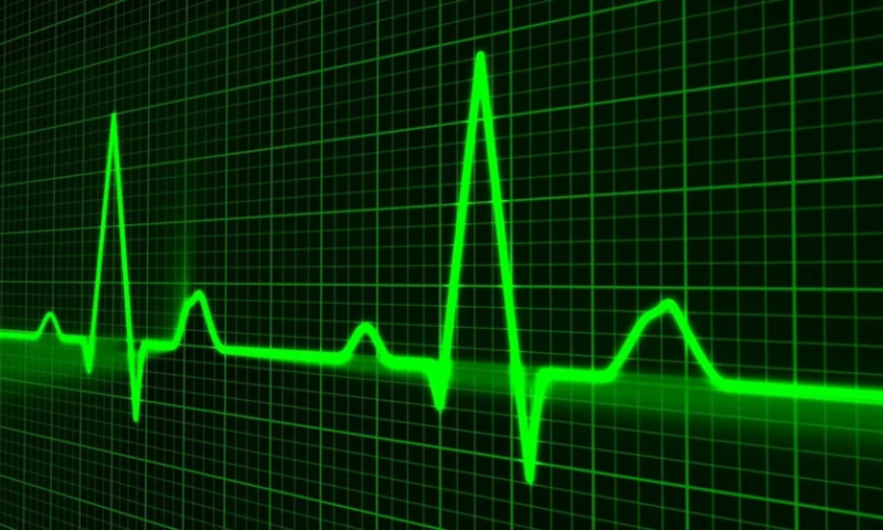 Mayo Clinic, Janssen AI to detect pulmonary hypertension scores FDA breakthrough nod