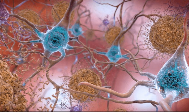 C2N launches tau-tallying Alzheimer’s blood test to join its amyloid-based screening tool