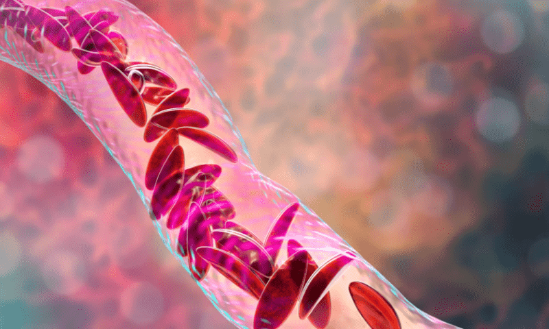 Pfizer’s $5.4B GBT buy adds potential sickle cell disease ‘cure’ and former Sanofi candidates