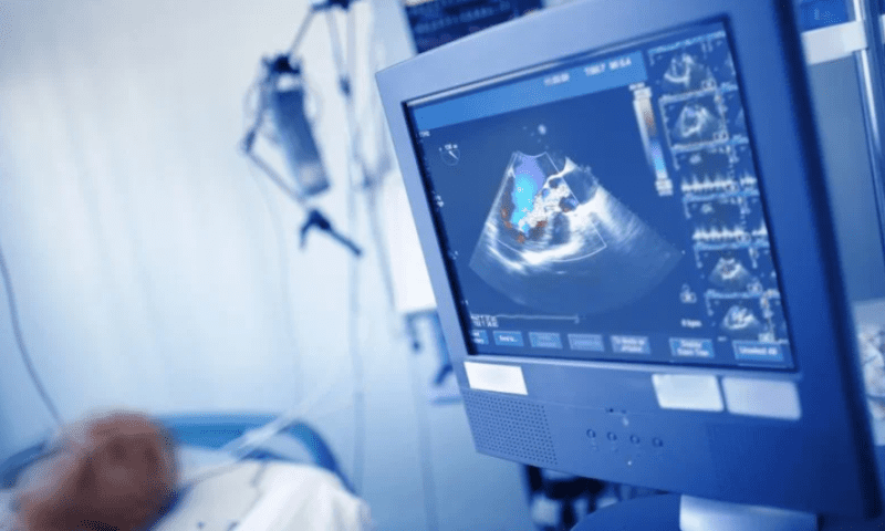 UltraSight claims European approval for AI-guided heart ultrasound