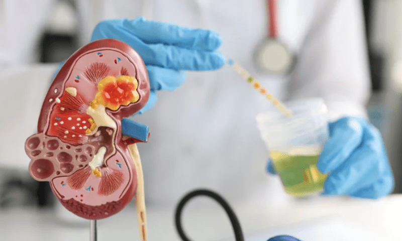 Novartis’ MS drug Gilenya could inspire new chronic kidney disease treatment
