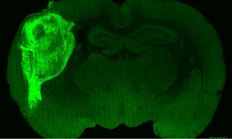 Human neurons grow in rat brains in first human-rat brain hybrids