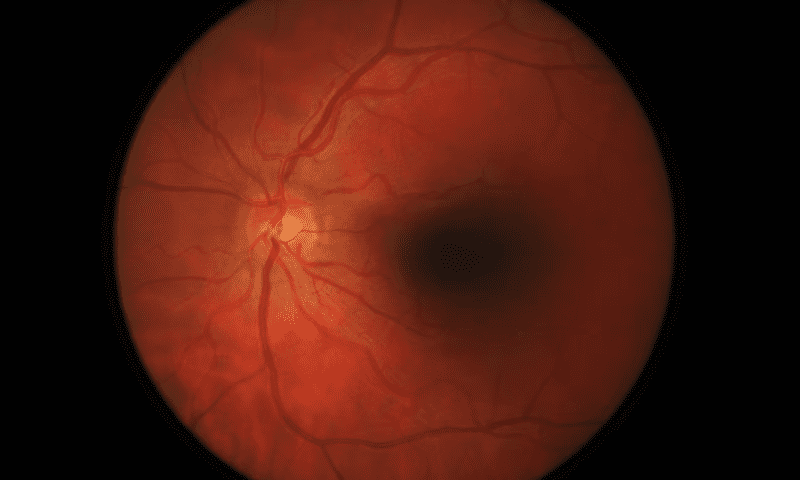 Quick retina scans may be AI’s key to predicting heart disease, study says