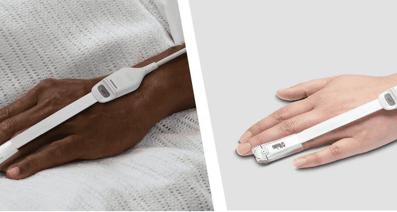 Masimo’s pulse oximeter is accurate for both Black and white patients, study finds