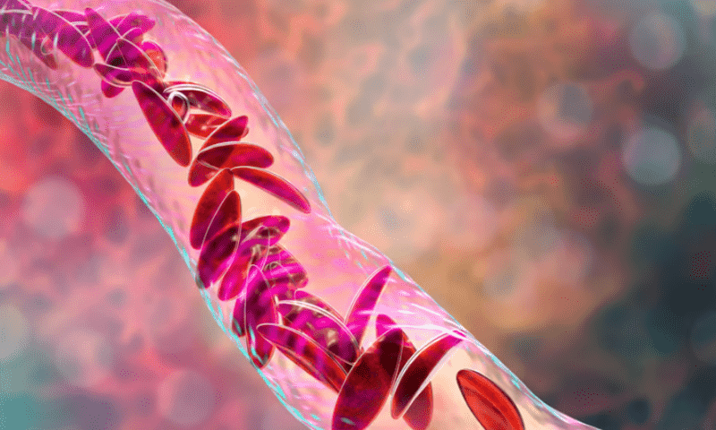 Editas teases tiny sickle cell sample in effort to climb back into gene editing’s upper echelon