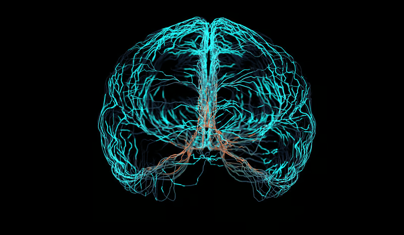 Aidoc nets FDA clearances for AI detection of aortic tears, medium-vessel strokes