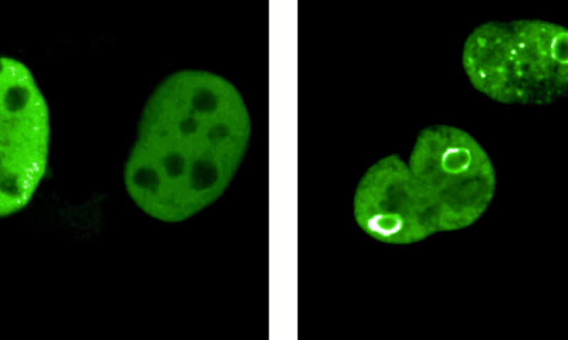 Spearing a sphere of MYC proteins could kill cancer cells