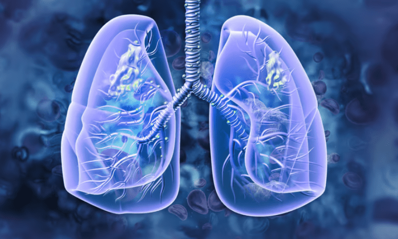 AI-calculated biomarker could predict how lung cancer patients respond to immunotherapy