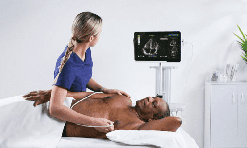 GE HealthCare snaps up ultrasound AI maker Caption Health