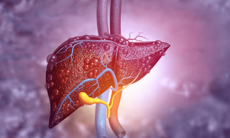 Chasing Akero, 89bio reduces scarring in midphase NASH trial to hit primary goals, tee up phase 3