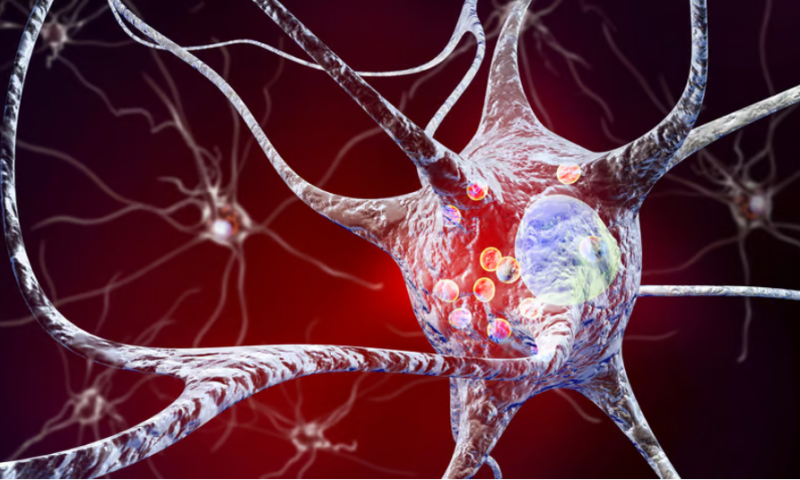 New test detects Parkinson’s biomarker before movement symptoms start