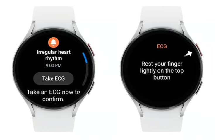 Samsung Galaxy Watch joins Apple Watch, Fitbit with FDA nod for afib-warning feature