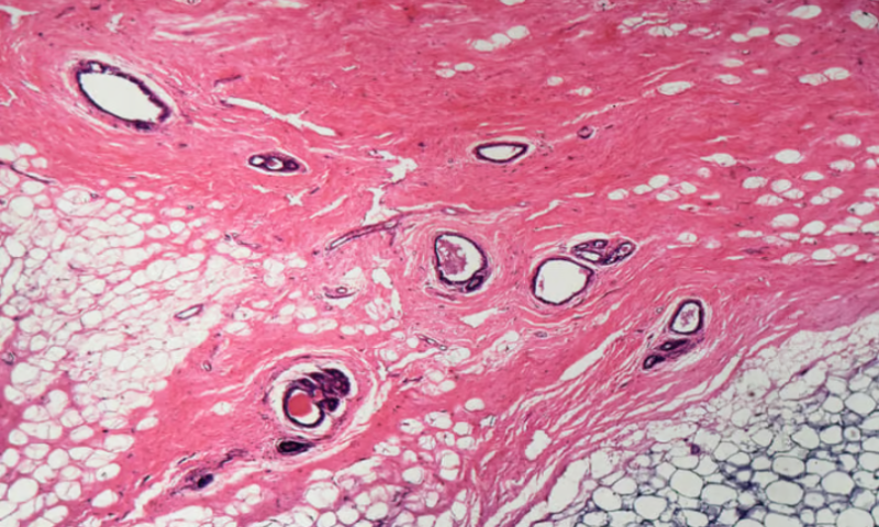 Human Breast Cell Atlas reveals all cells in human breast tissue, with some surprises