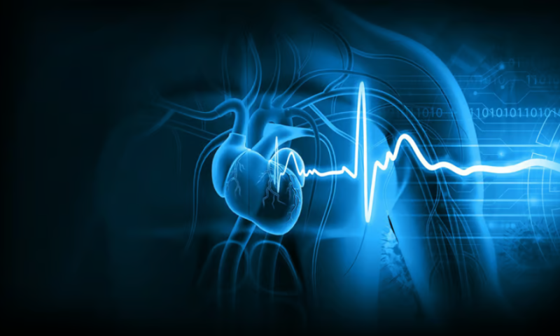 Viz.ai collects de novo clearance for BMS-backed software to spot hypertrophic cardiomyopathy