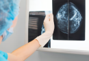 Mammogram AI shows more promise, performing as well as radiologists in breast cancer screening study