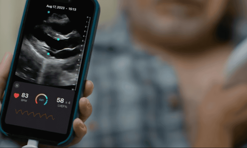 Exo brings AI heart, lung apps to its hand-held ultrasound probe