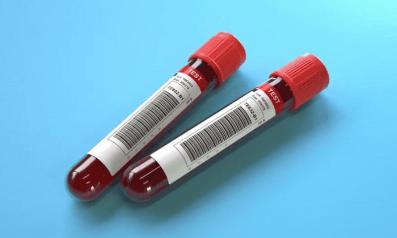 Labcorp nets companion diagnostic approval for Pfizer’s hemophilia B gene therapy Beqvez