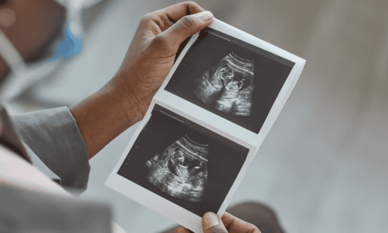 GE HealthCare drops $51M to buy OB/GYN-focused ultrasound AI