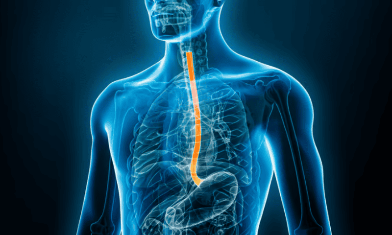 As esophageal cancer incidence rises, trials and potential treatments burgeon: Novotech report