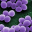 Inflammatix collects $57M as it awaits FDA review of infectious disease test