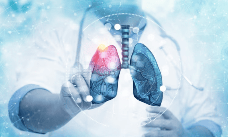 Boehringer’s phase 3 lung fibrosis trial hits primary endpoint, teeing up filings for Ofev successor