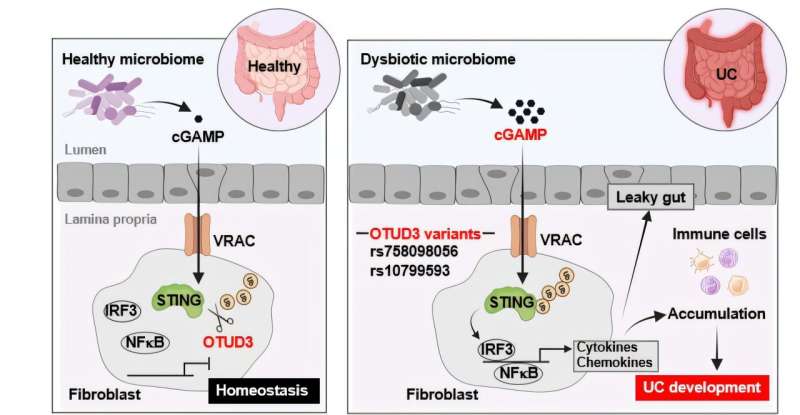 Intestinal flora works together with certain genes to aggravate ulcerative colitis, research reveals